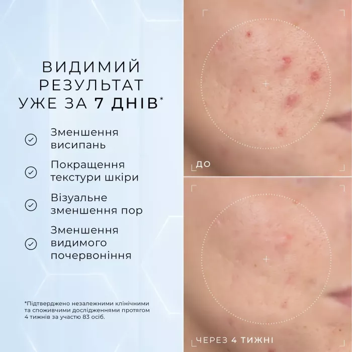 СИРОВАТКА ДЛЯ ОБЛИЧЧЯ З НІАЦИНАМІДОМ 10% NIACINAMIDE PEPTIDES MEDIK8
