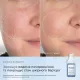 СИРОВАТКА ДЛЯ ОБЛИЧЧЯ З НІАЦИНАМІДОМ 10% NIACINAMIDE PEPTIDES MEDIK8