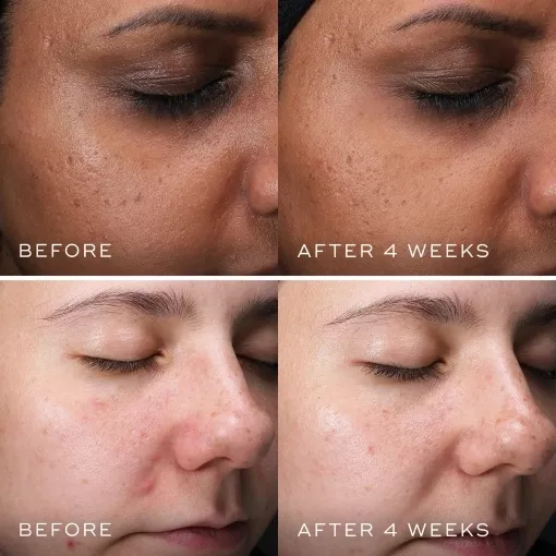 СИРОВАТКА З НІАЦИНАМІДОМ 10% CLARITY PEPTIDES™ MEDIK8