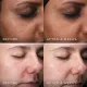 СИРОВАТКА З НІАЦИНАМІДОМ 10% CLARITY PEPTIDES™ MEDIK8