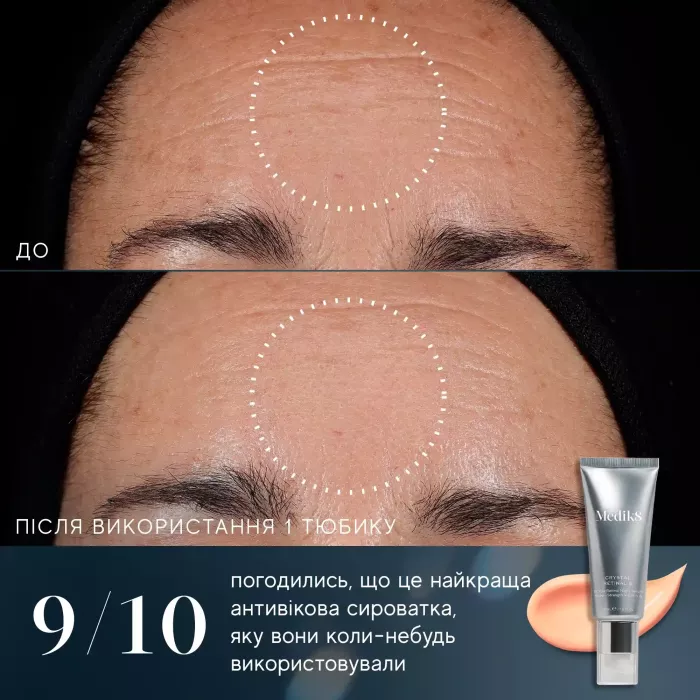 Crystal Retinal 6